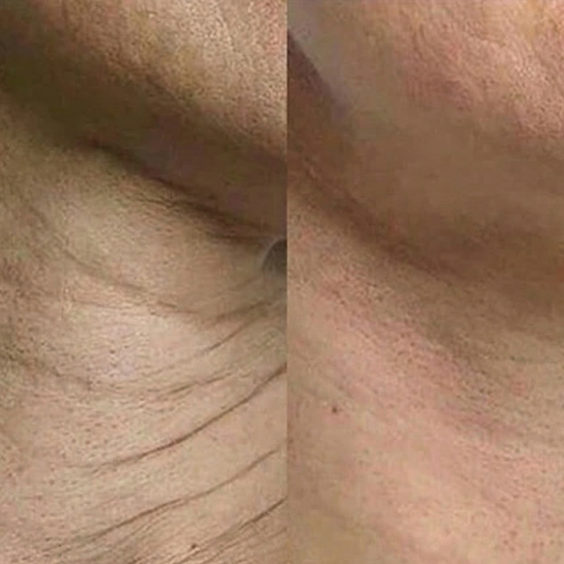 Dr. Melaxin® Calcium Balm