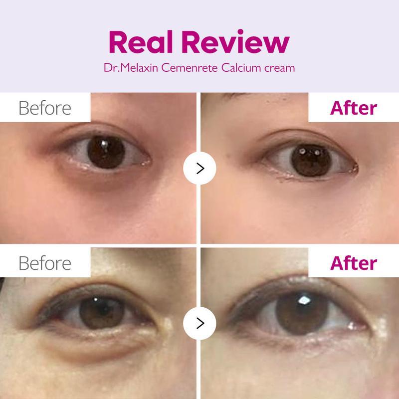 Dr. Melaxin® Cemenrete Calcium Intense Cream