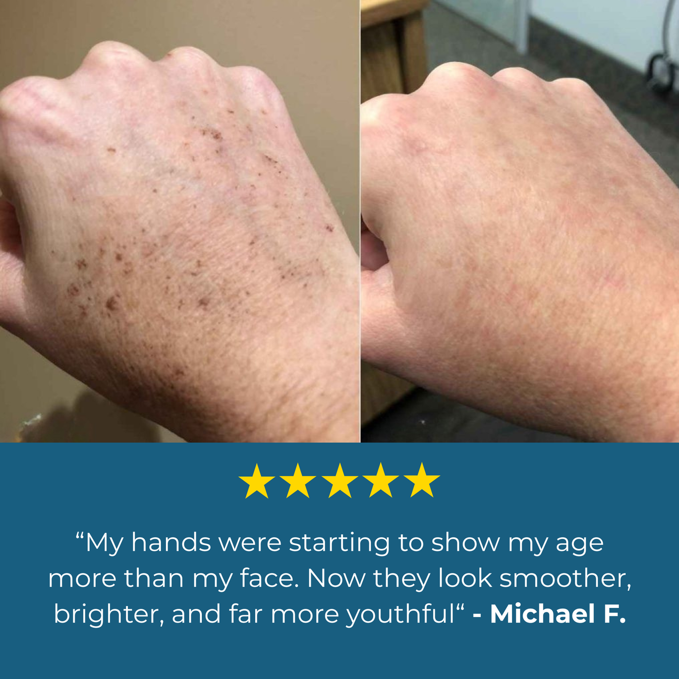 Dr. Melaxin® Age Spots Cream