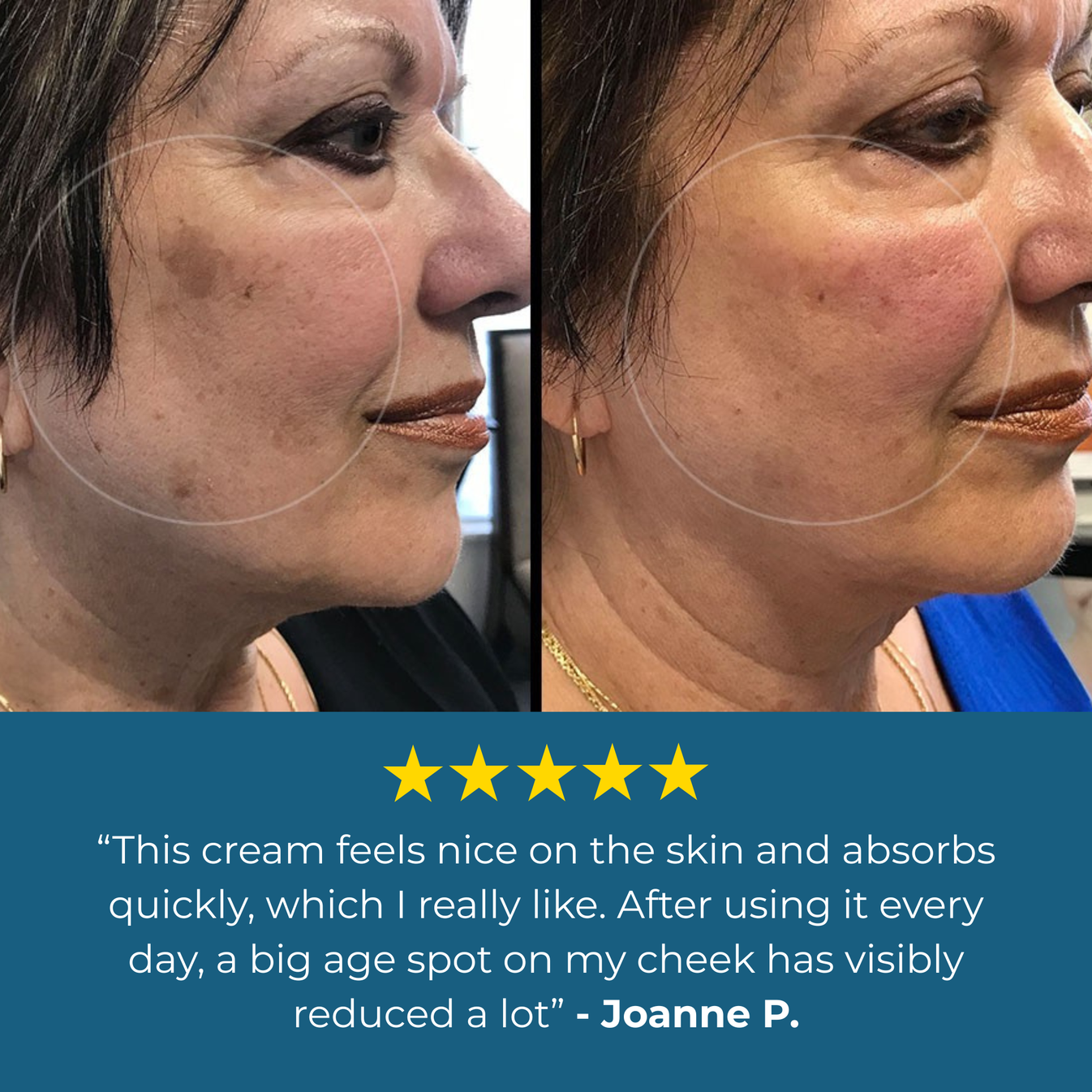 Dr. Melaxin® Age Spots Cream